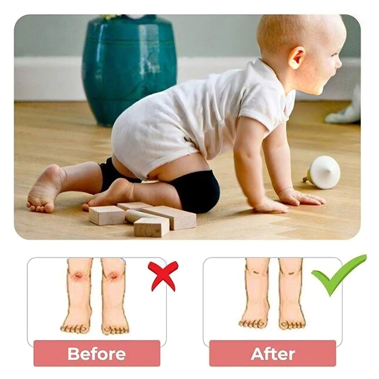 Kids Elbow Safety Protector